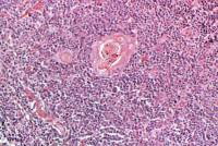 Thymus jeune x100